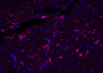 Donkey Anti-Rabbit IgG H&L, BF594 conjugated