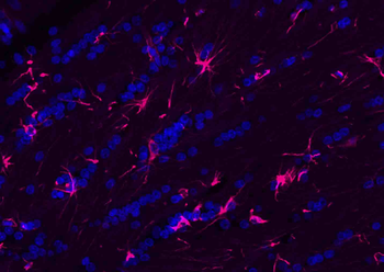 Donkey Anti-Rabbit IgG H&L, BF594 conjugated