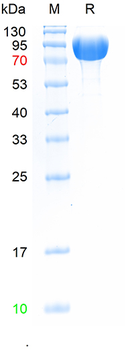 Recombinant human CD31 protein, C-His (HEK293)