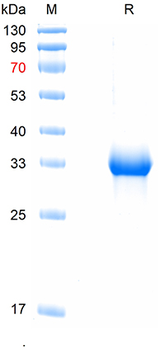 Recombinant human PR3 protein, C-His (HEK293)