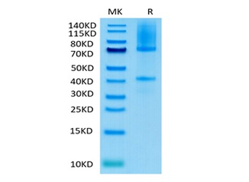 Recombinant human Glypican 3 protein, C-His-Avi (HEK293), Biotin conjugated
