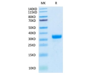 Recombinant human Angiopoietin-2 protein, N-His-Avi (HEK293), Biotin conjugated