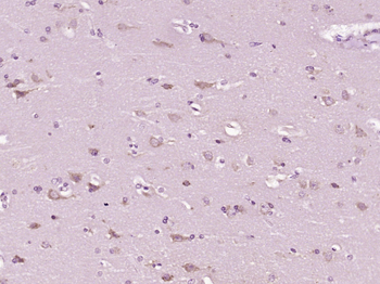 Complement fragment 3c Rabbit Polyclonal Antibody