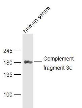 Complement fragment 3c Rabbit Polyclonal Antibody