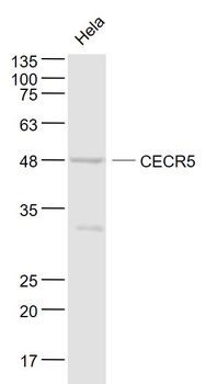 CECR5 Rabbit Polyclonal Antibody