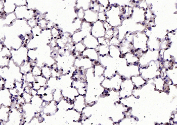 RGC32/C13orf15 Rabbit Polyclonal Antibody
