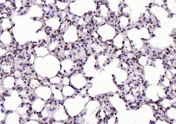 RGC32/C13orf15 Rabbit Polyclonal Antibody