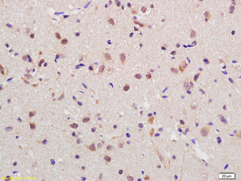 RGC32/C13orf15 Rabbit Polyclonal Antibody