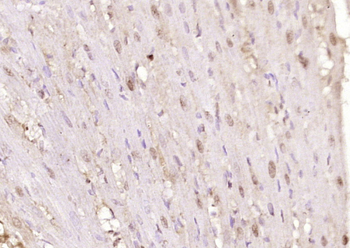 HSPB2 Rabbit Polyclonal Antibody