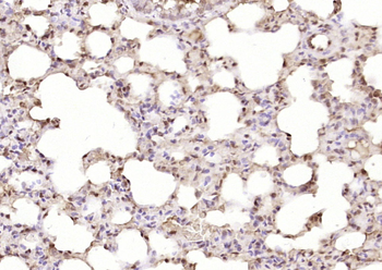 HSPB2 Rabbit Polyclonal Antibody