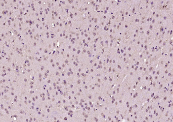 EGR2 Rabbit Polyclonal Antibody