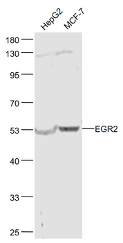 EGR2 Rabbit Polyclonal Antibody