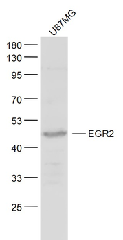 EGR2 Rabbit Polyclonal Antibody