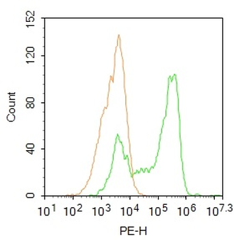CTDSPL Rabbit Polyclonal Antibody