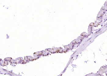 CTDSPL Rabbit Polyclonal Antibody