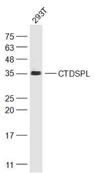 CTDSPL Rabbit Polyclonal Antibody