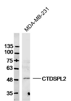 CTDSPL2 Rabbit Polyclonal Antibody