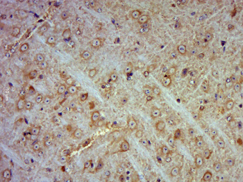 CUTA Rabbit Polyclonal Antibody