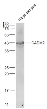 CADM2 Rabbit Polyclonal Antibody
