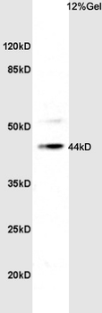 TBX1 Rabbit Polyclonal Antibody