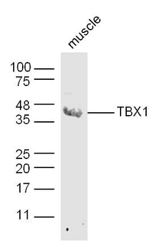 TBX1 Rabbit Polyclonal Antibody