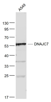 DNAJC7 Rabbit Polyclonal Antibody