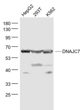 DNAJC7 Rabbit Polyclonal Antibody