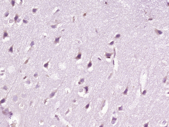 CRMP5 Rabbit Polyclonal Antibody