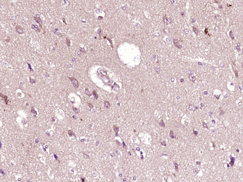 Phospho-CRMP2 (Thr514+Ser518) Rabbit Polyclonal Antibody