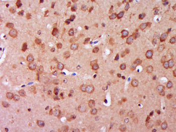 TXNRD1 Rabbit Polyclonal Antibody
