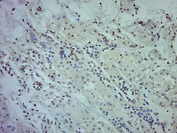 TXNRD1 Rabbit Polyclonal Antibody