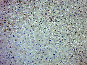 TXNRD1 Rabbit Polyclonal Antibody