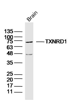 TXNRD1 Rabbit Polyclonal Antibody