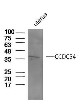 CCDC54 Rabbit Polyclonal Antibody