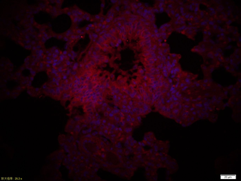 Phospho-CSK (Ser364) Rabbit Polyclonal Antibody (BF594)