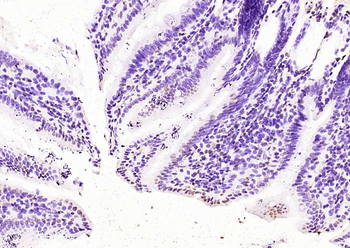 UBE2W Rabbit Polyclonal Antibody