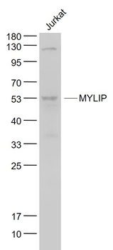 MYLIP Rabbit Polyclonal Antibody