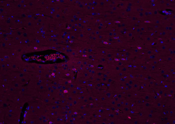 VIP Rabbit Polyclonal Antibody (BF555)