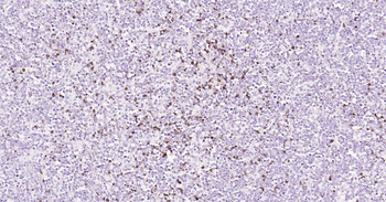Human CD5 Ready-To-Use IHC Kit