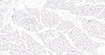 Human CD5 Ready-To-Use IHC Kit