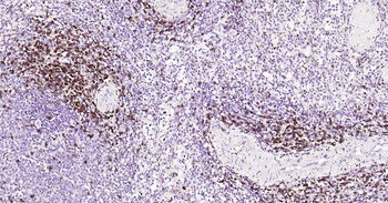 Human CD5 Ready-To-Use IHC Kit