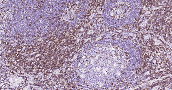 Human CD5 Ready-To-Use IHC Kit