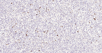 Human CD80 Ready-To-Use IHC Kit