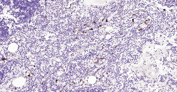 Human CD80 Ready-To-Use IHC Kit