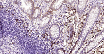 Human CD138 Ready-To-Use IHC Kit