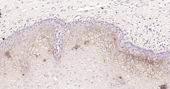 Human CD138 Ready-To-Use IHC Kit
