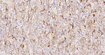 Human CD138 Ready-To-Use IHC Kit