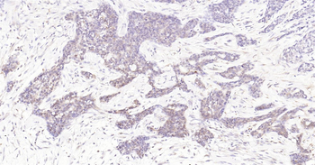 Human STAT1 Ready-To-Use IHC Kit