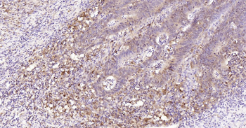 Human STAT1 Ready-To-Use IHC Kit