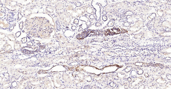 Human STAT1 Ready-To-Use IHC Kit